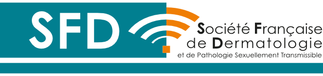 SFD